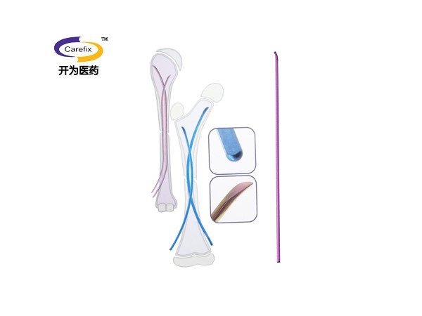 上海開為Carefix第二代彈性髓內(nèi)針