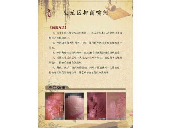 眾復(fù)生殖區(qū)抑菌噴劑