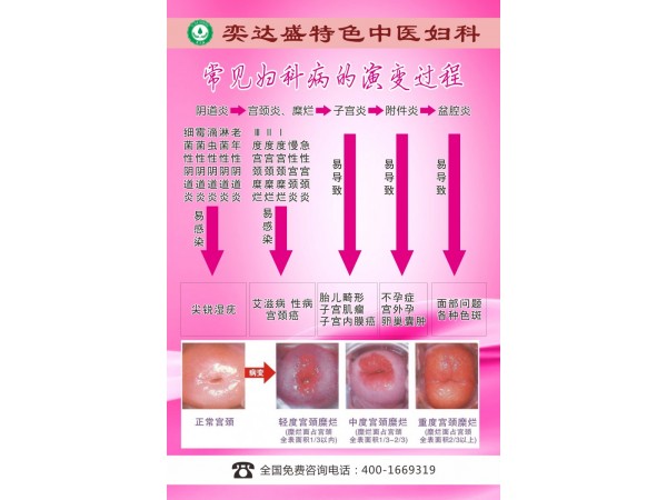 玉迷散