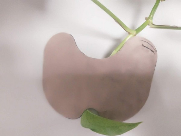 醫(yī)用冷敷膝蓋貼