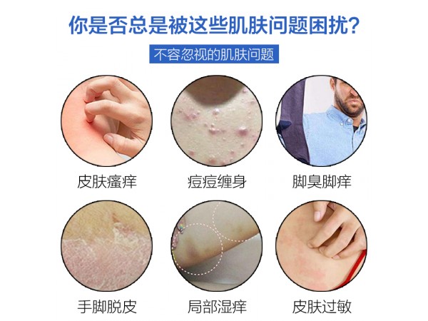 溢美抑菌軟膏