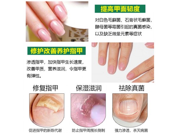 溢美精油
