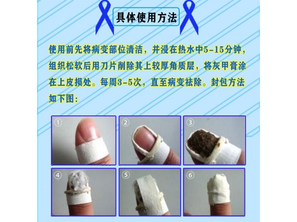 溢美灰甲膏