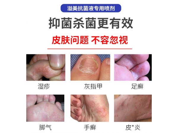 溢美噴霧劑