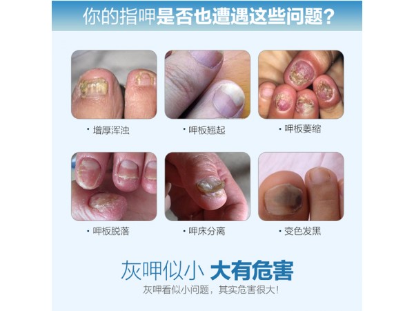 溢美魔術(shù)筆