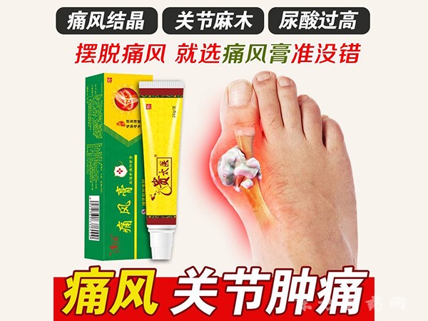 痛風膏 外用乳膏