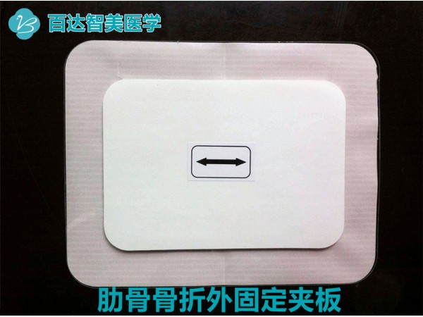 肋骨（胸骨）固定板（武漢百達智美醫(yī)學）產(chǎn)品優(yōu)勢和操作使用特點