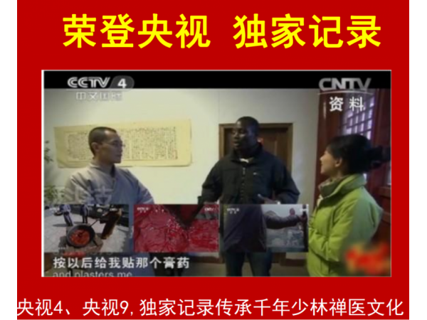 少林熱灸膏