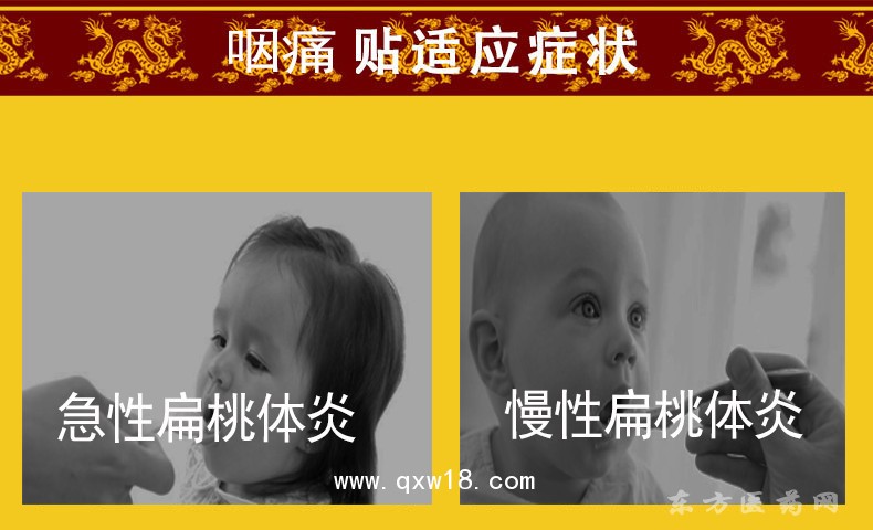 小兒咽痛貼批發(fā)代理定制定做醫(yī)院診所中標(biāo)掛網(wǎng)