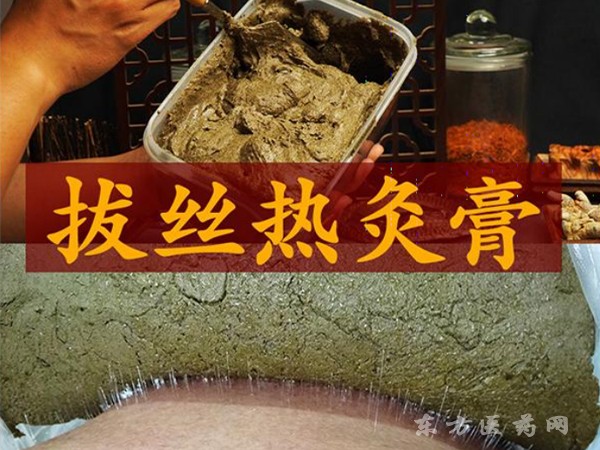 拔絲熱灸膏