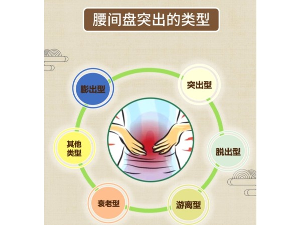 遠(yuǎn)紅外磁療貼廠家黑膏藥貼pu膜防水防汗外用貼劑可貼牌代加工