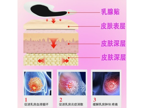 乳腺貼貼牌代加工東進藥業(yè)婦科乳腺貼膏藥代加工