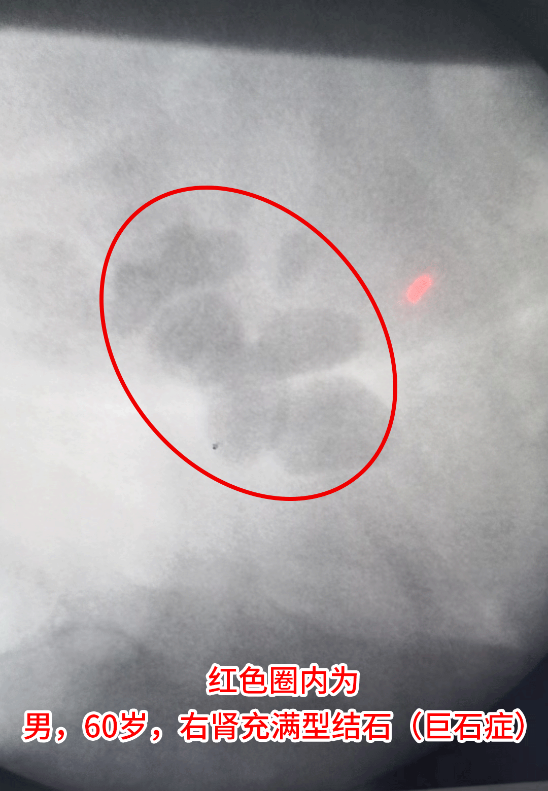 d9718b2dccb0f94df9925e187302536f_1710207770675900.png