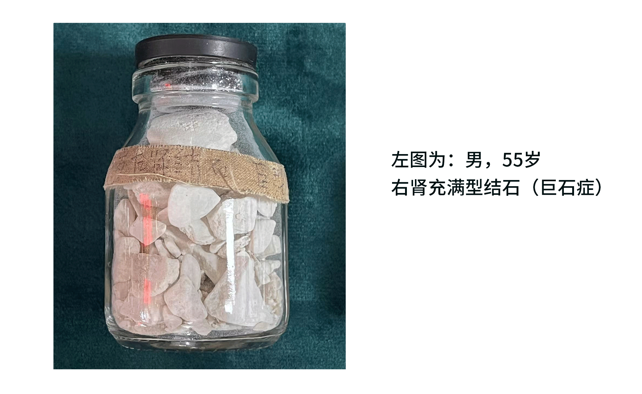 5685790d4abf3841a691393106c84570_1710207876651888.png